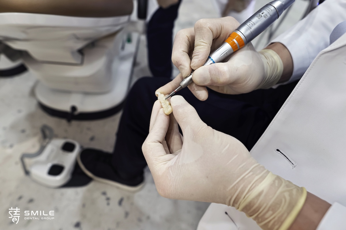 李 先生 蒔美 薛聖儒 磨牙調整_83A0126