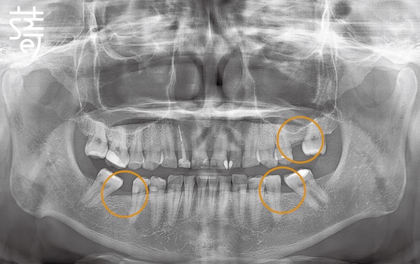 李 先生 蒔美 薛聖儒 磨牙2 PX_STANDARD_20230801_113853-01