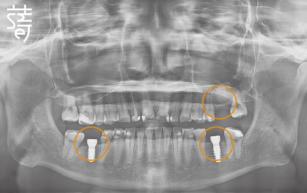 李 先生 蒔美 薛聖儒 磨牙2 PX_STANDARD_20230801_113853-02