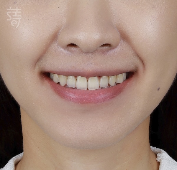 調整 _MG_9982 拷貝