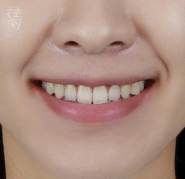 調整 _MG_9982 拷貝