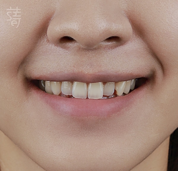 調整 _MG_9982 拷貝