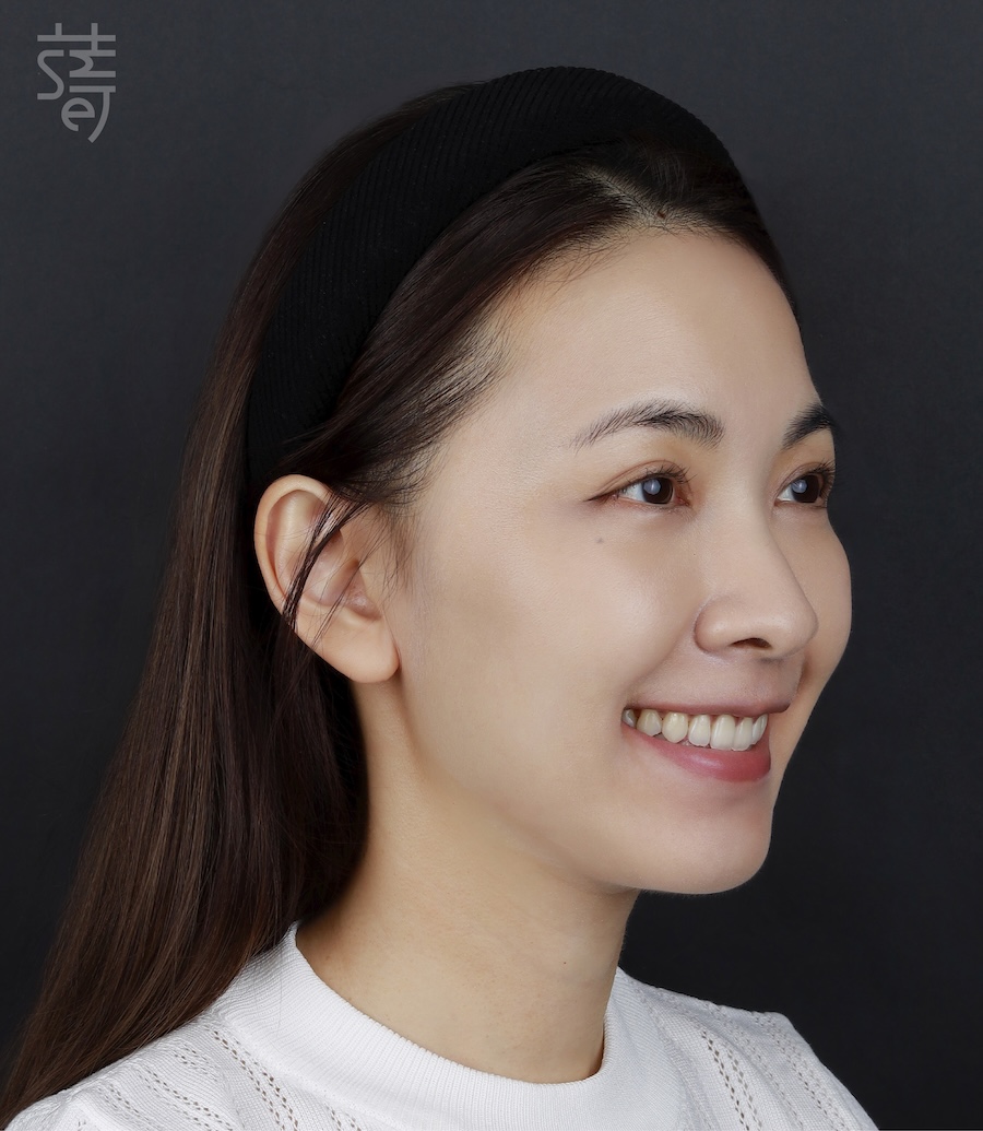 調整 _MG_9982 拷貝