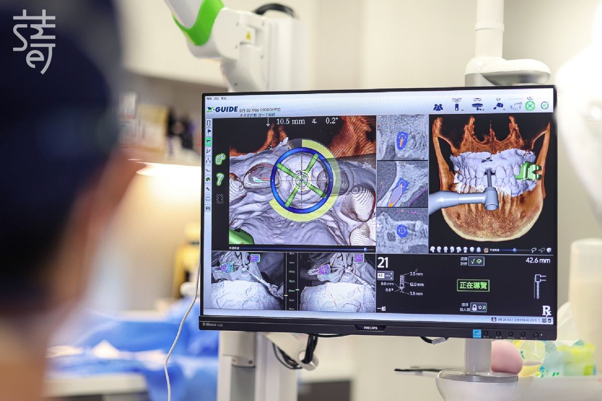 蒔美麻醉鎮靜專科團隊 字 x-guide