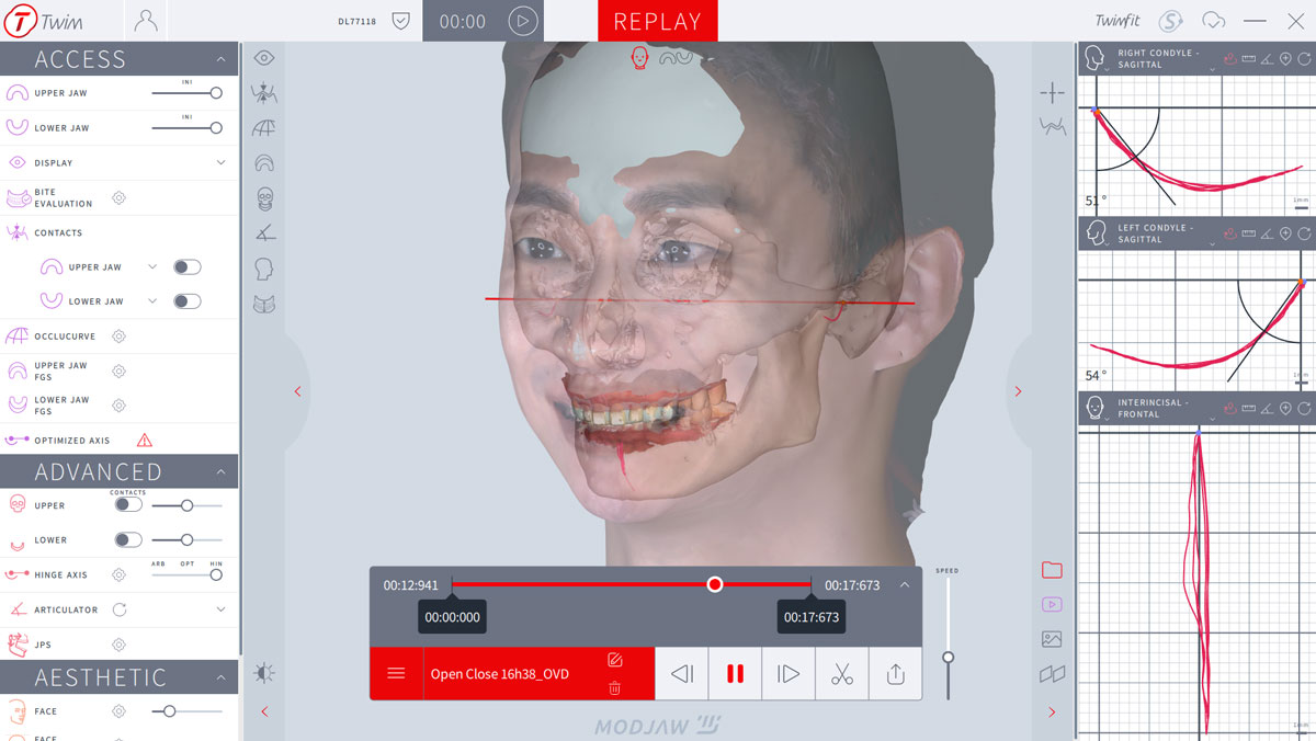 25_07_04_10_25_55_979