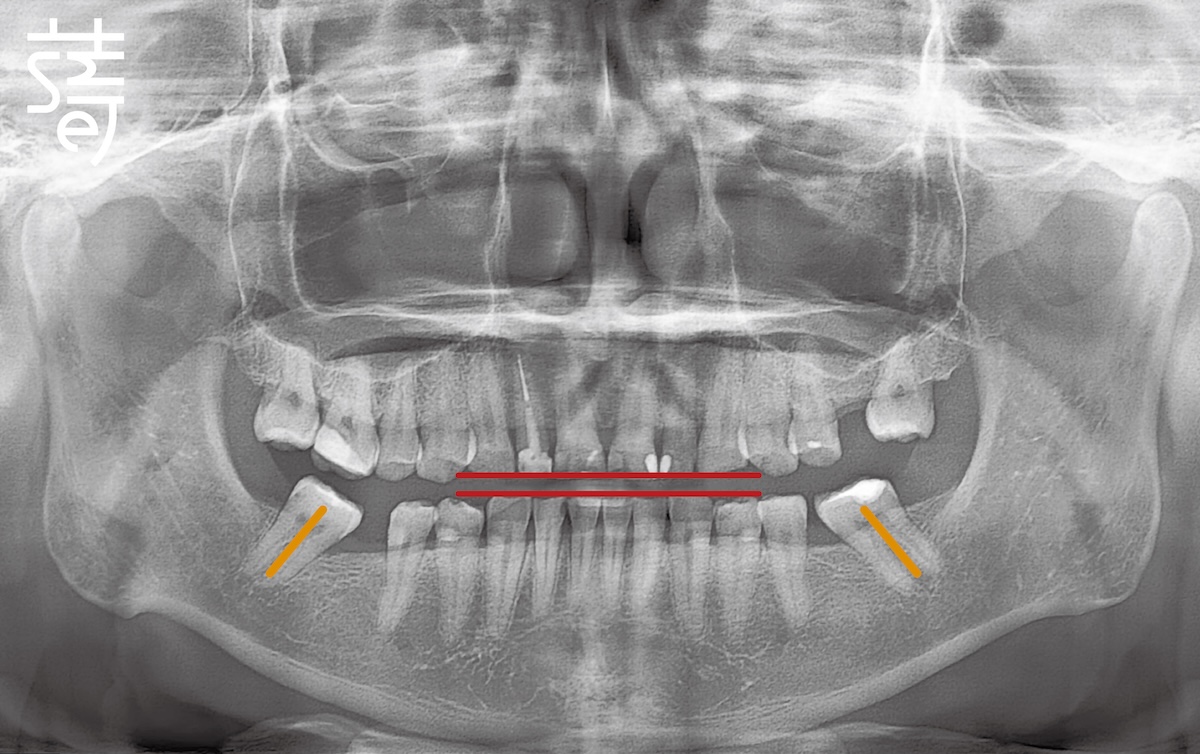 PX_STANDARD_20230801_113853