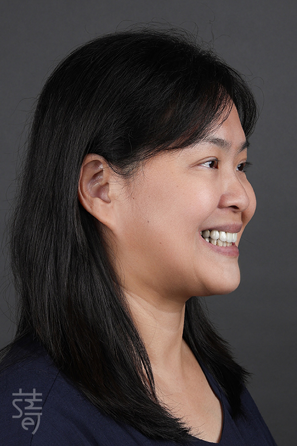 IMG_0178黃植牙從恐懼到重生:全口植牙重建讓陳太太重拾美食人生