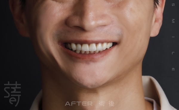 李 先生 蒔美 薛聖儒 磨牙_MG_0431