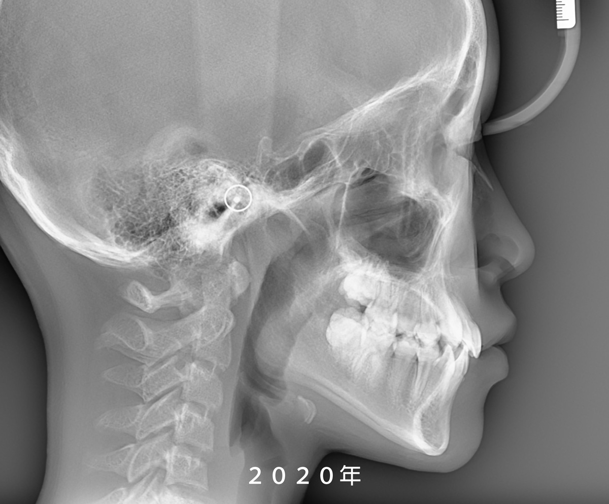 20200820陳冠妘-測顱-改