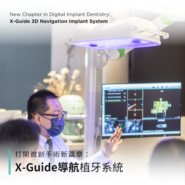 41-比傳統植牙精準11倍？X-Guide3D植牙導航系統，打開「微創手術」新篇章