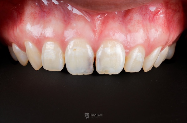 _MG_9817_有logo-林(糖糖)