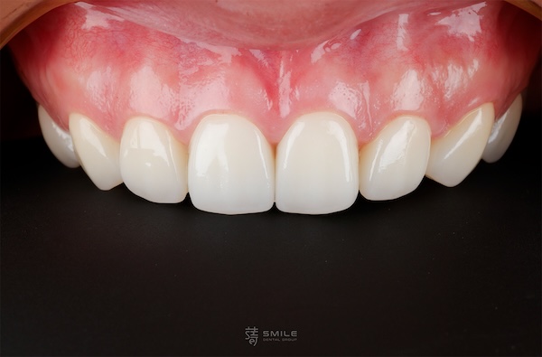 _MG_9826_有logo-林(糖糖)