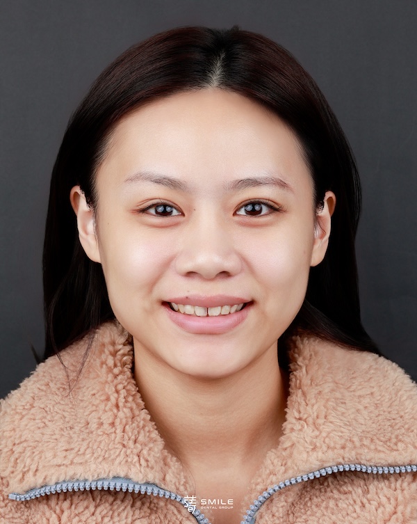 _MG_9946-林(糖糖)