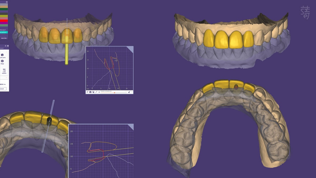 2026-01-03_17-09-39 1200