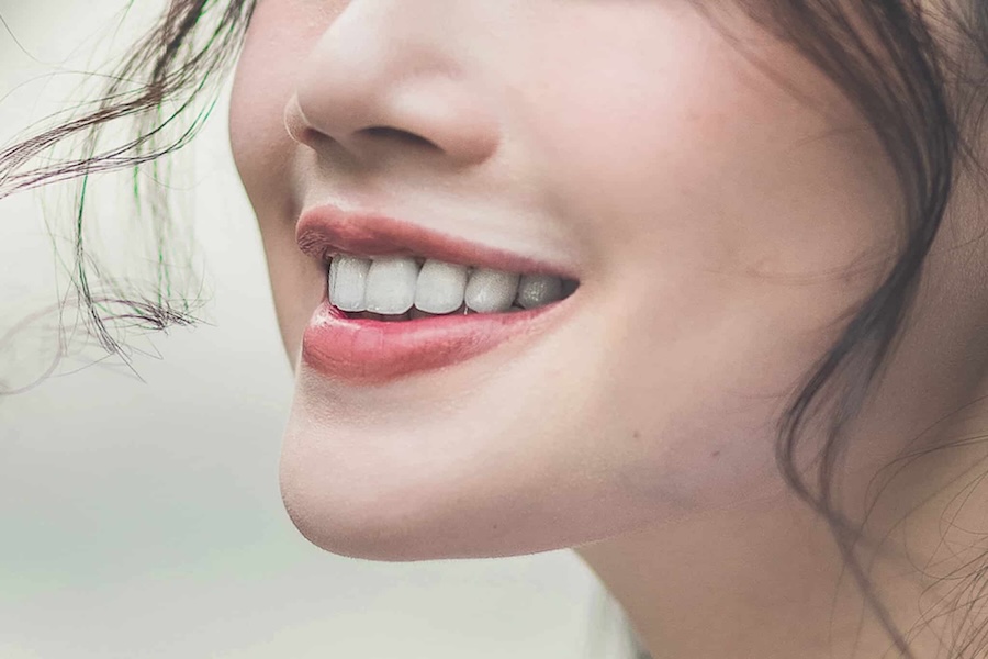 全瓷貼片蒔美案例113 900