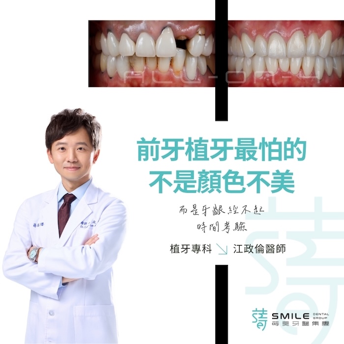 前牙植牙最怕的不是顏色不美，而是牙齦經不起時間考驗