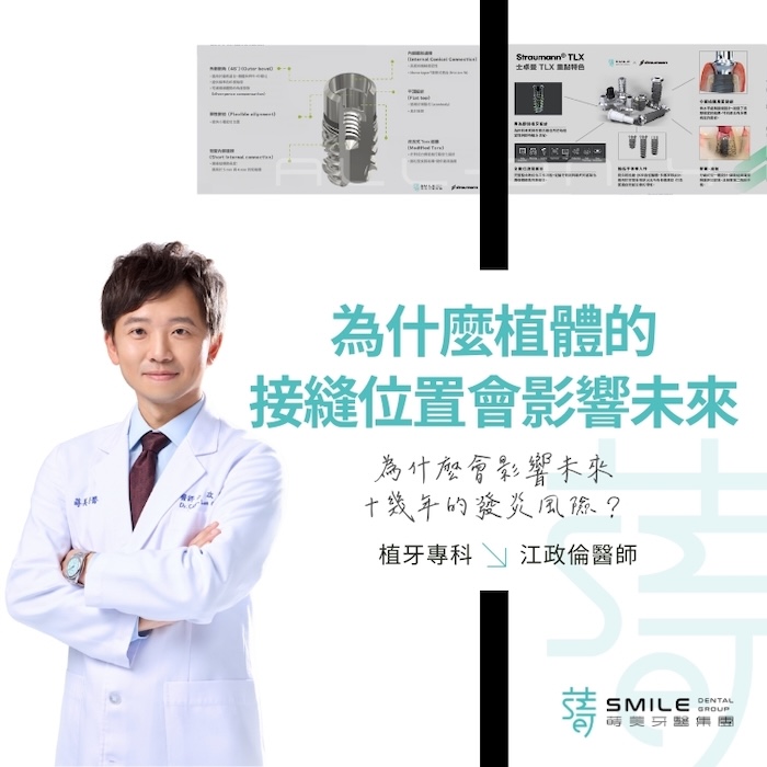 為什麼植體的接縫位置，會影響未來十幾年的發炎風險