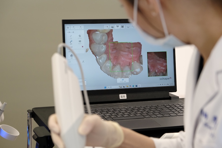 DSCF0637 數位口內掃描