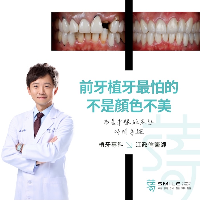 前牙植牙最怕的不是顏色不美，而是牙齦經不起時間考驗