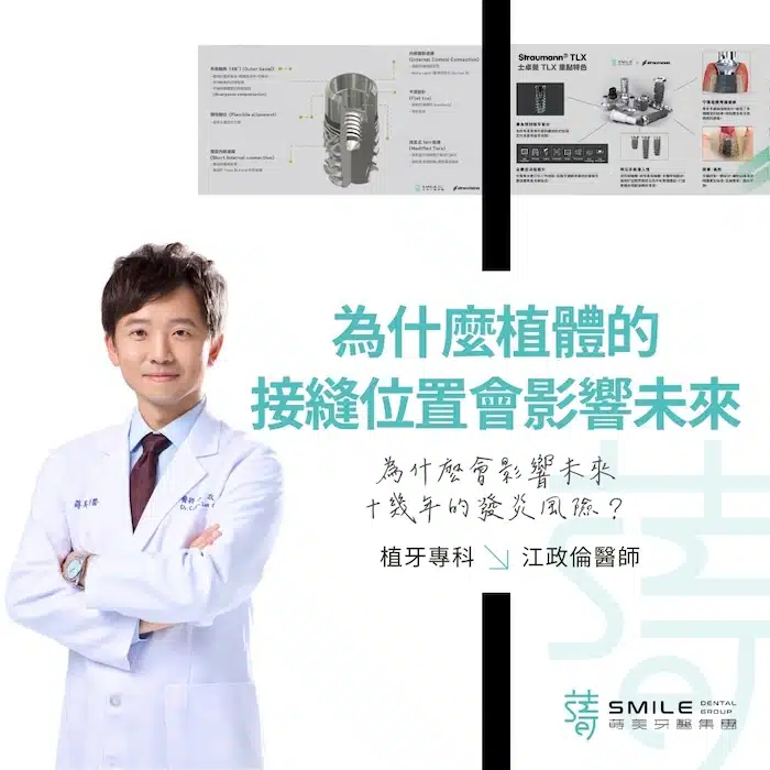 為什麼植體的接縫位置，會影響未來十幾年的發炎風險