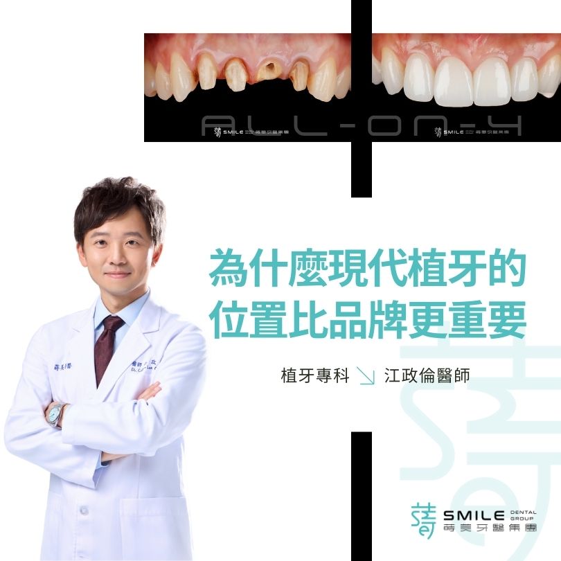 為什麼現代植牙的 位置比品牌更重要