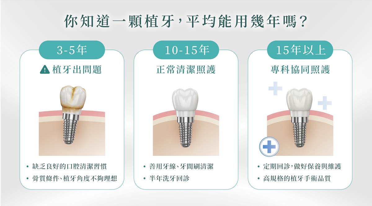 植牙真正的挑戰 是在十年之後-01