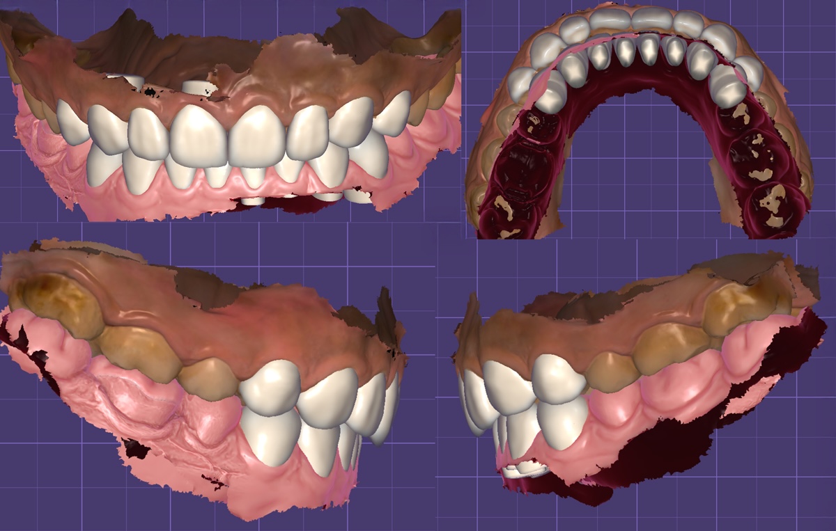 DSD 田 各象限觀
