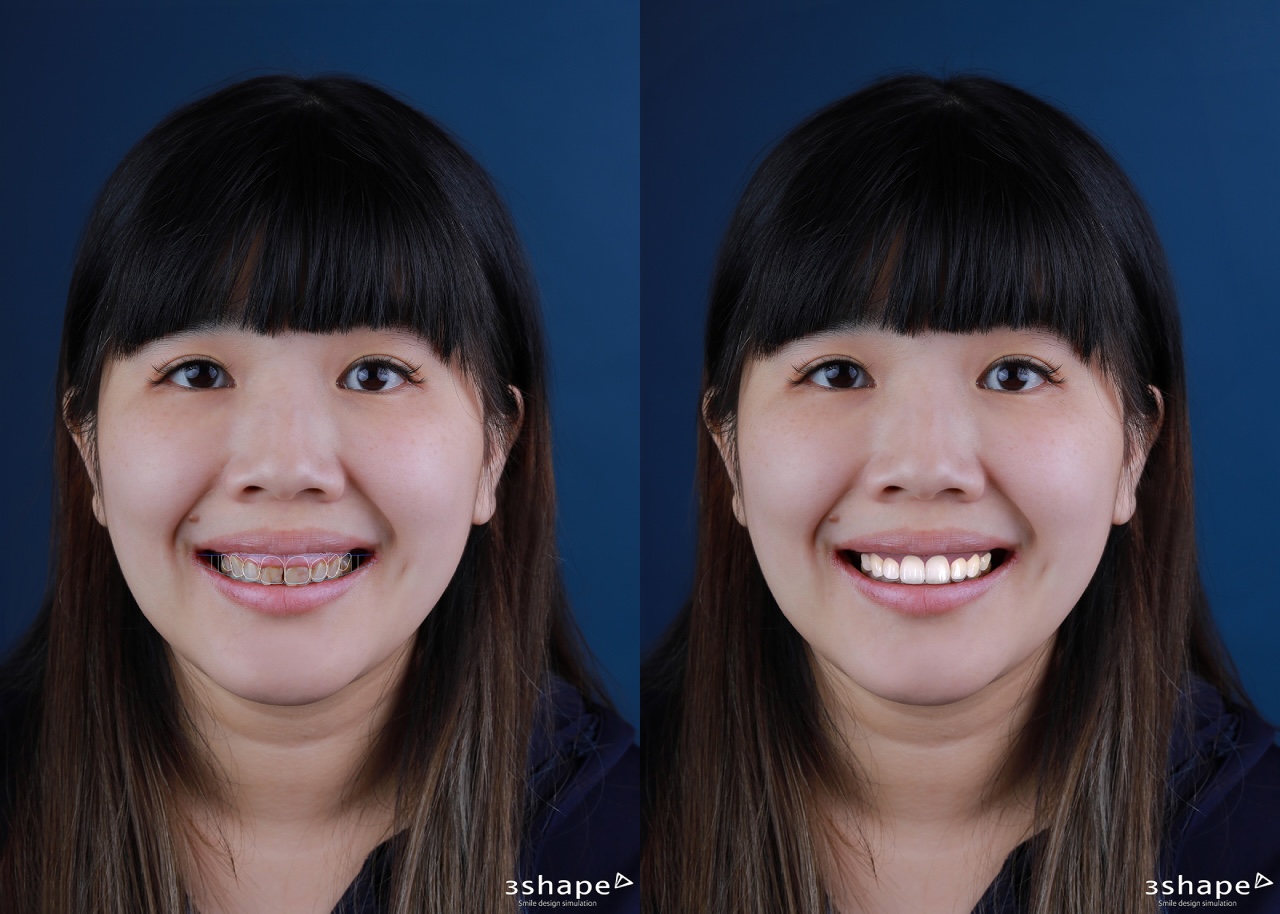 品牌理念-數位微笑設計-吳