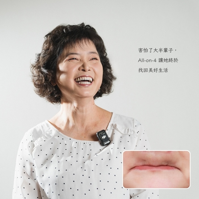 害怕了大半輩子，All-on-4 讓她終於找回美好生活