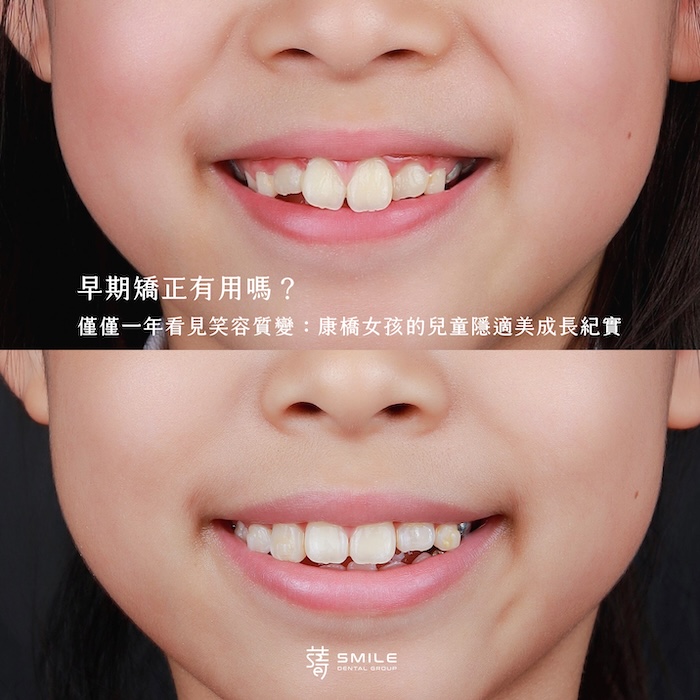 小綺案例封面照_MG_9348 拷貝