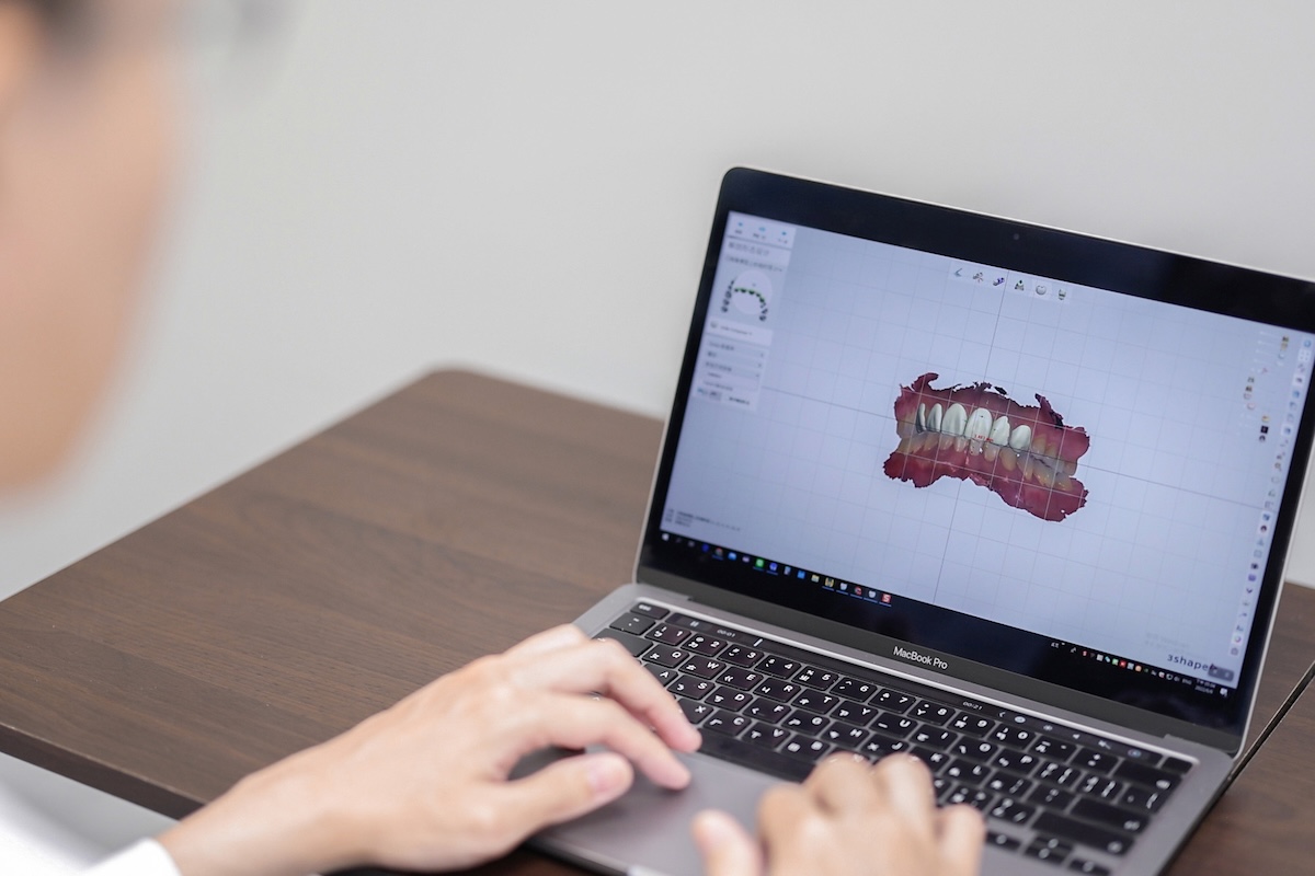 數位微笑設計DSD