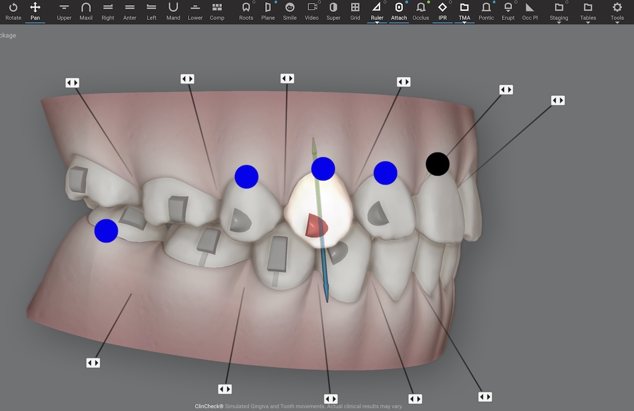 隱適美設計畫面