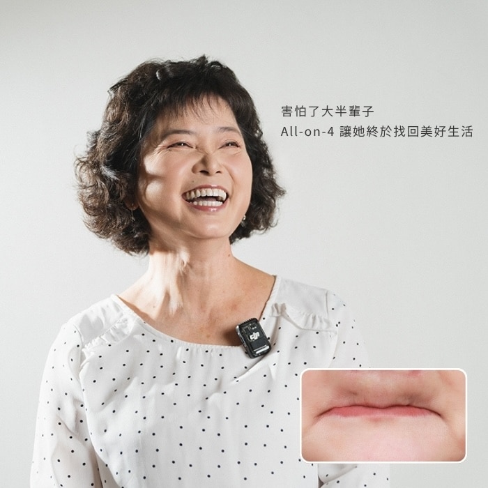 害怕了大半輩子,All-on-4 讓她終於找回美好生活