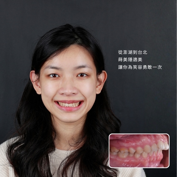 從澎湖到台北，蒔美隱適美，讓你為笑容勇敢一次