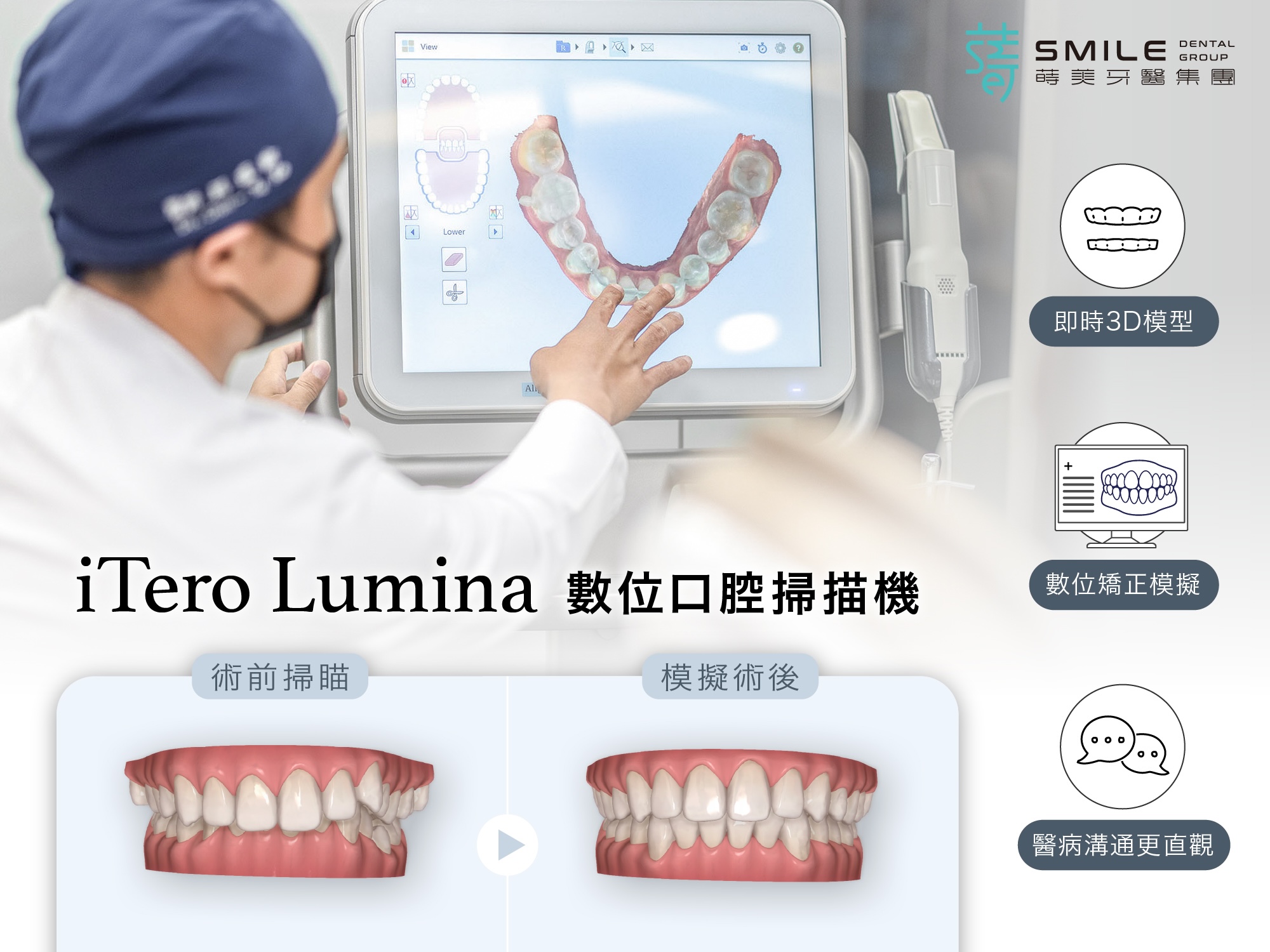 數位口掃機 柯醫師講解 隱適美模擬 即時3D模型、數位矯正模擬、醫病溝通更直觀