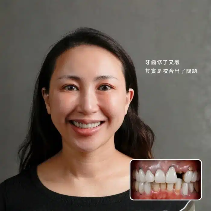 牙齒修了又壞，其實是咬合出了問題
