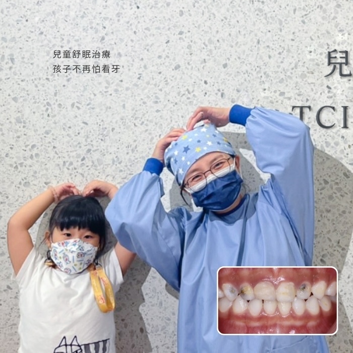 兒童舒眠治療 孩子不再怕看牙