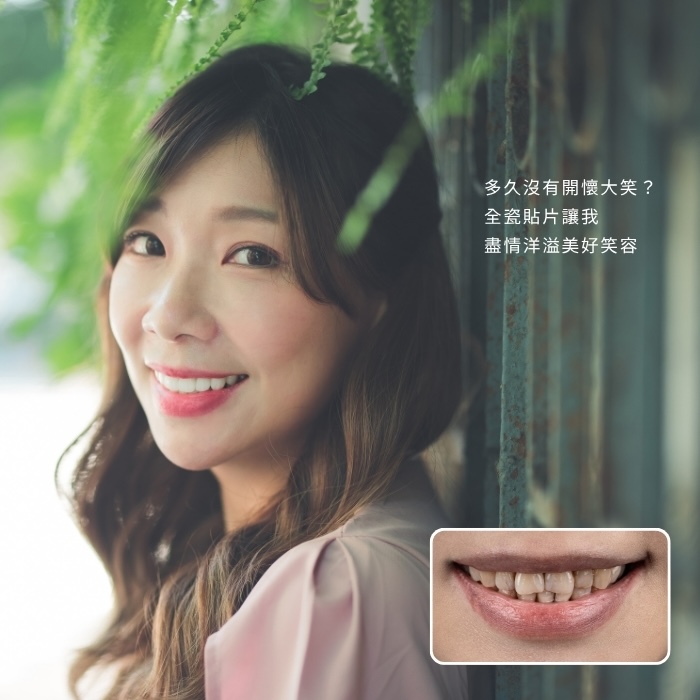多久沒有開懷大笑？全瓷貼片讓我盡情洋溢美好笑容