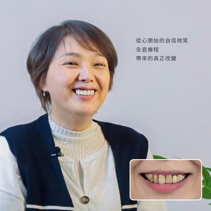 從心開始的自信微笑：全瓷療程帶來的真正改變