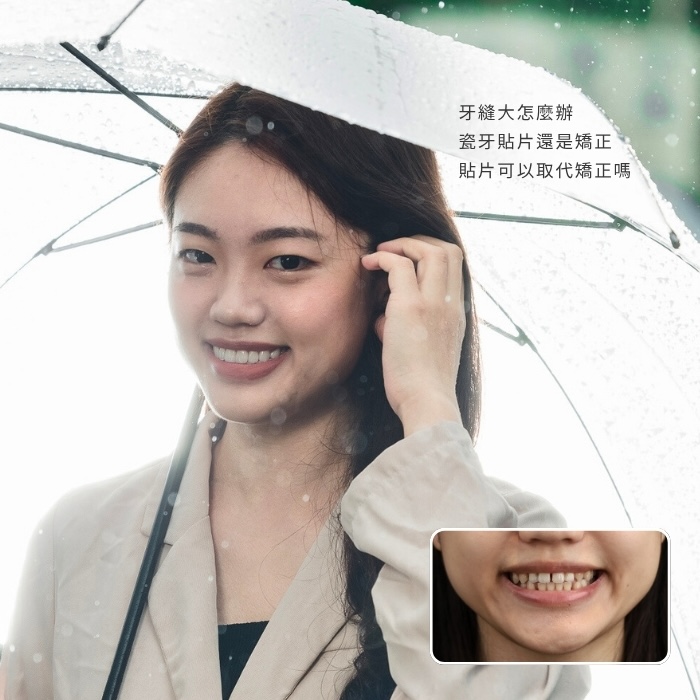 牙縫大怎麼辦？該做瓷牙貼片還是矯正？瓷牙貼片可以取代矯正嗎？板橋瓷牙貼片個案親身分享
