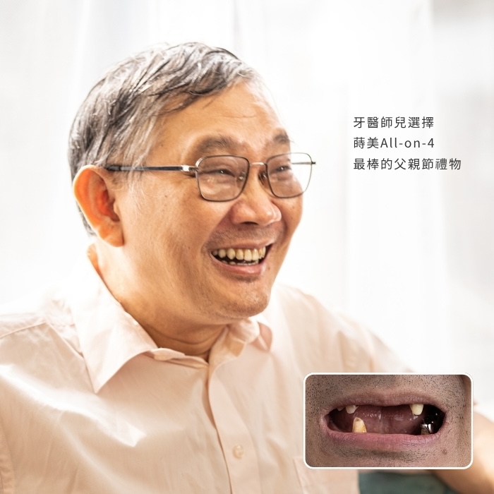 牙醫師兒選擇蒔美All-on-4，最棒的父親節禮物