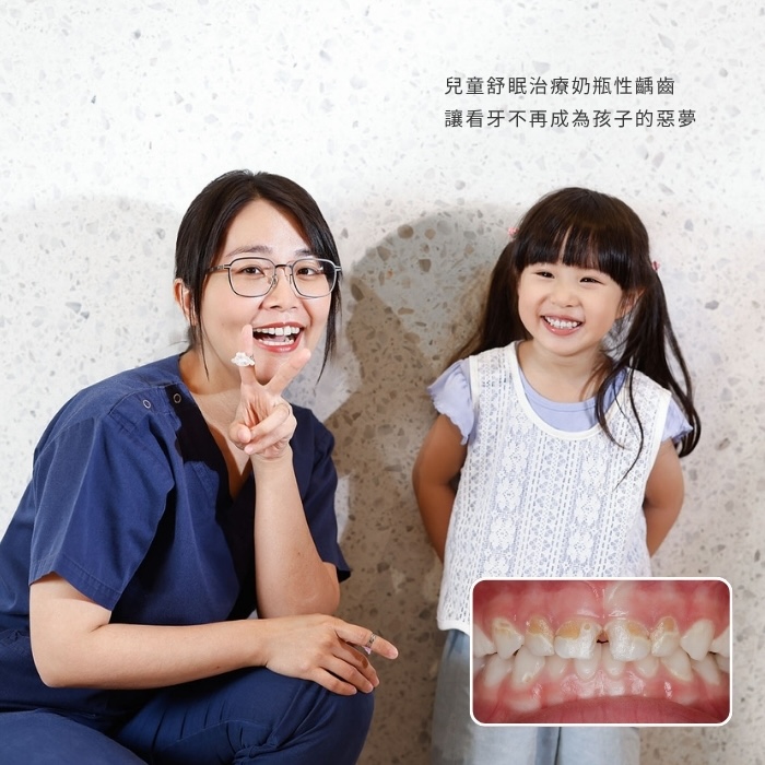 兒童舒眠治療奶瓶性齲齒 讓看牙不再成為孩子的惡夢