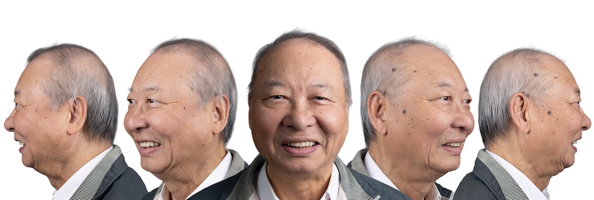 張 術後五面圖