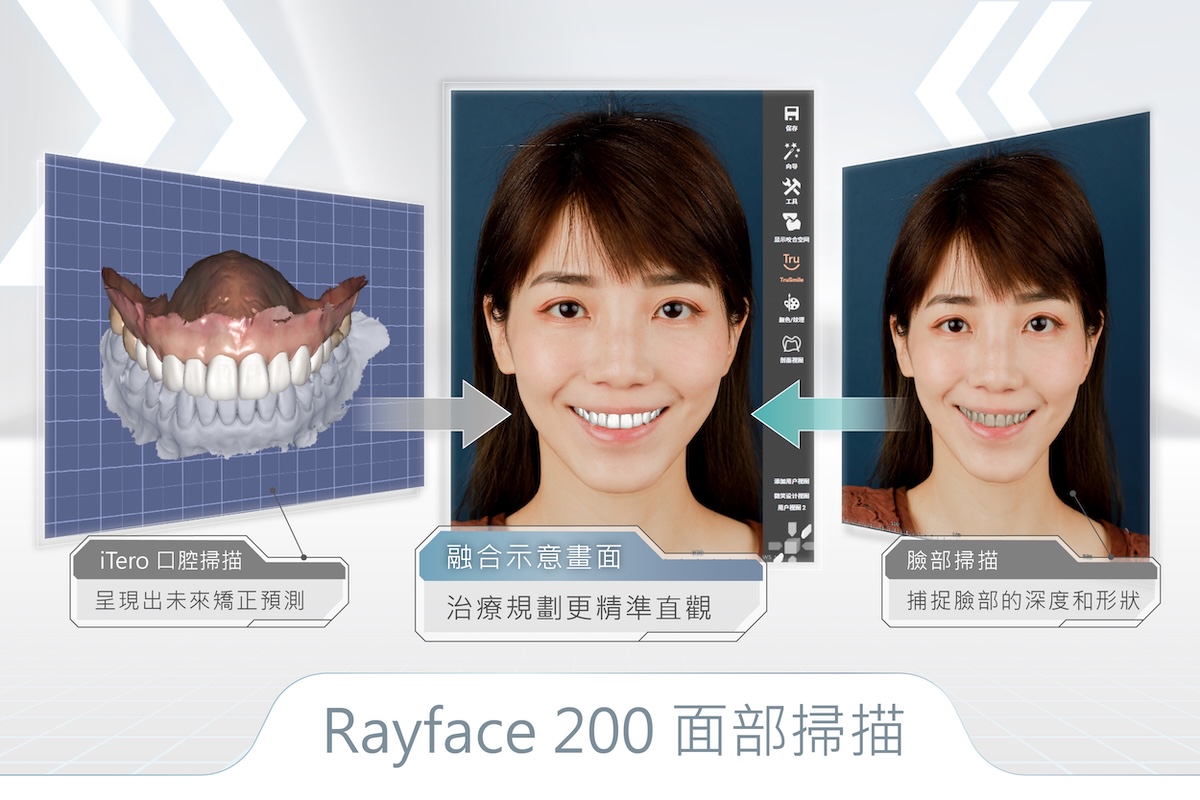 面部掃描 RayFace 200 3D 臉部掃描系統