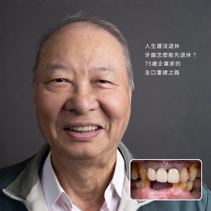 人生還沒退休，牙齒怎麼能先退休？75歲企業家的全口重建之路